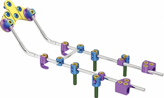 Spinal Implant Detailed View