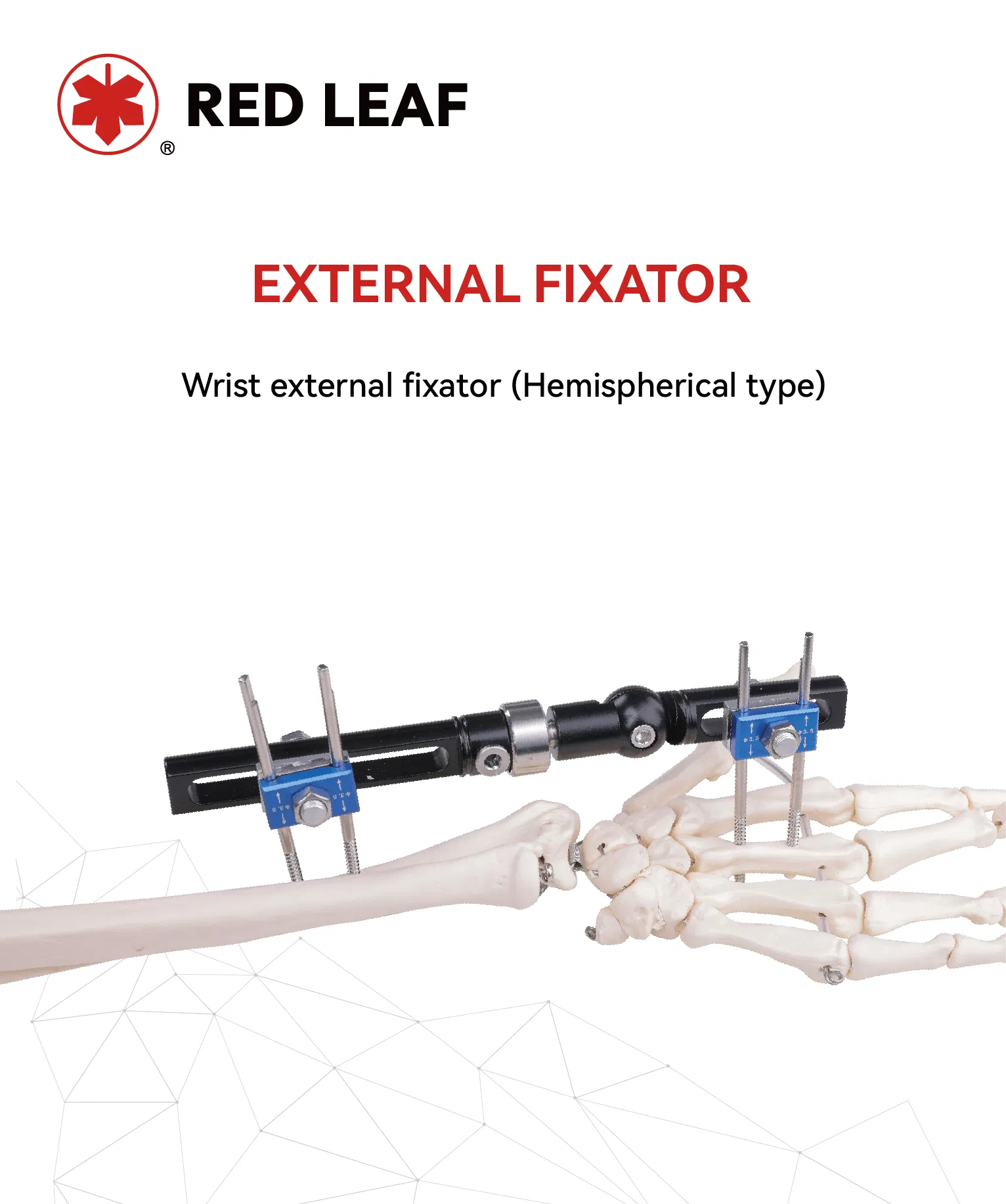 Surgical Wrist Fixator Overview