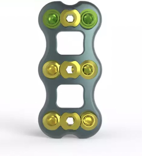 Anterior Cervical Fixation System with Screw for Cervical Spine with CE Certificate