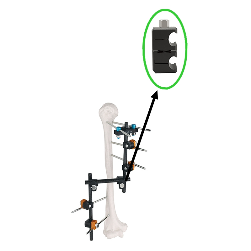 Surgical Fixation Ringent Pin to Rod Coupling External Fixator
