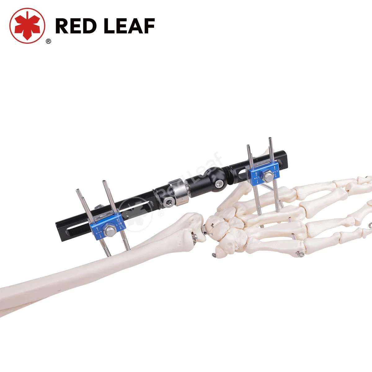 Durable Surgical Wrist Fixator for Effective Bone Stabilization Orthopedic Fixation