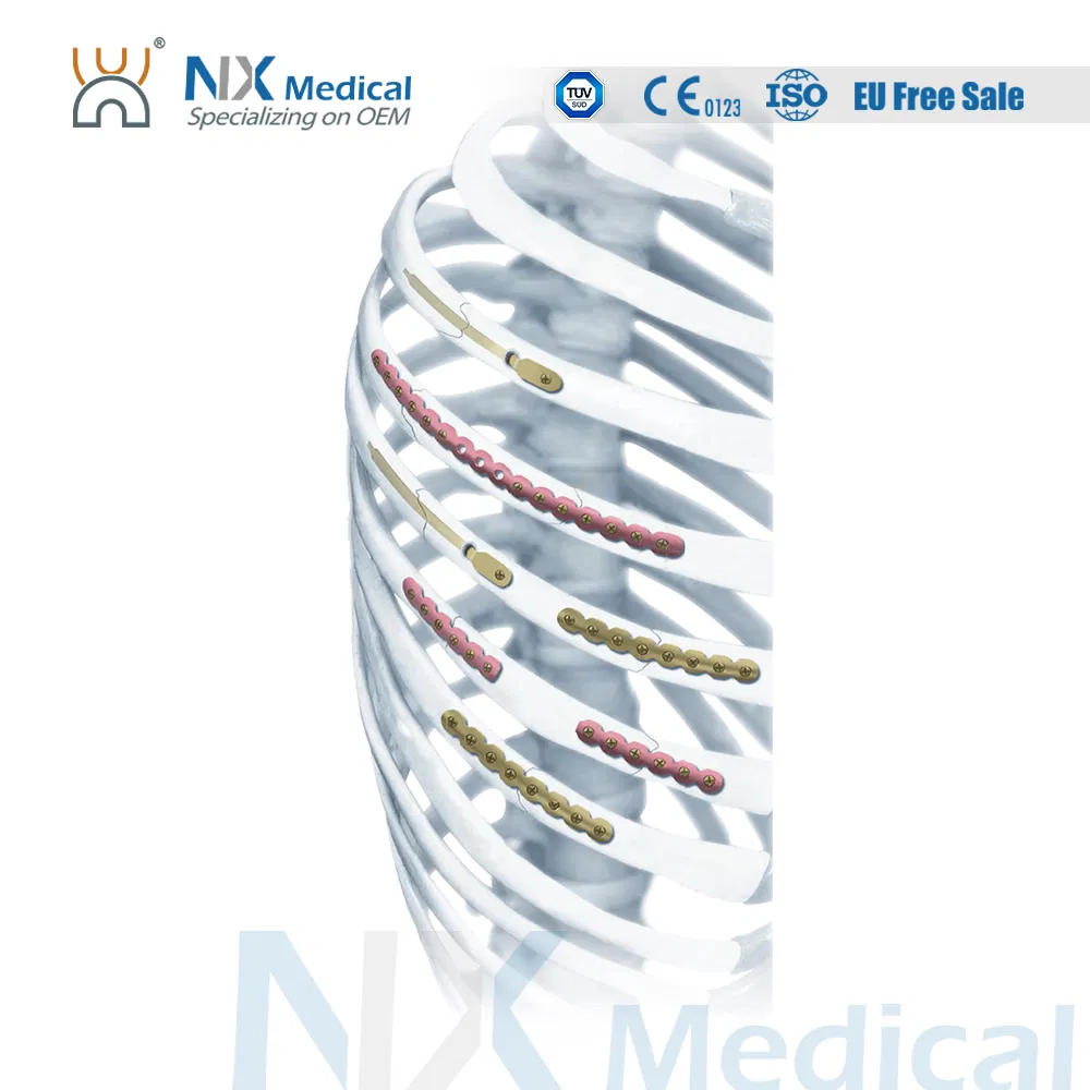 Nx Medical Titanium Locking Plate Rib 2.9mm System for Orthopedic Fixation