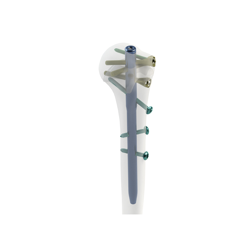 Premium Humeral Intramedullary Nail for Enhanced Fracture Support