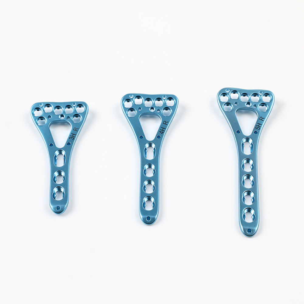 Variable-Angle Distal Radius Locking Plate for Orthopedic Trauma