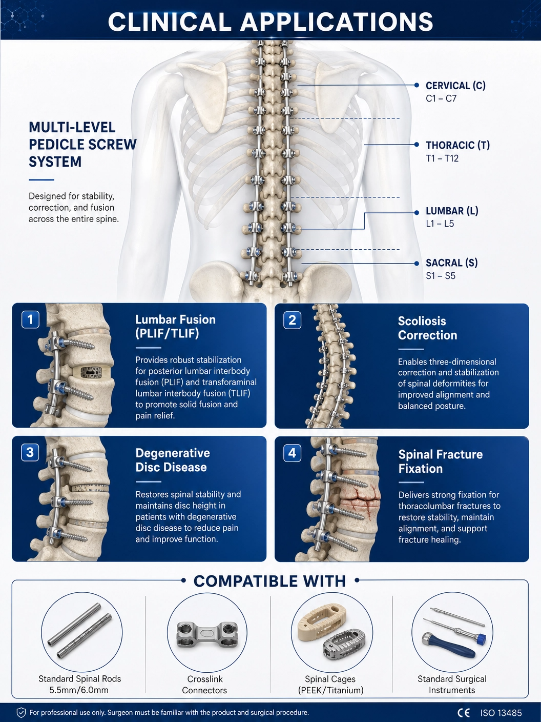 Factory Price 5.5mm Pedicle Screws Spinal Fixation System Titanium Orthopedic Spine Implants for Posterior Fixation