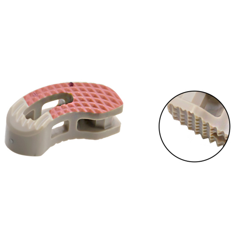 Geasure Orthopedic Surgical Implants Spine System TLIF Cage Titanium Alloy Class III 1 Year Warranty