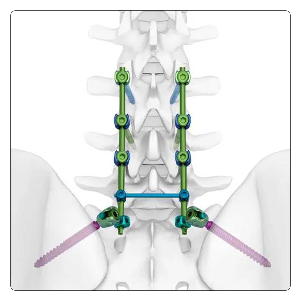 Spine System