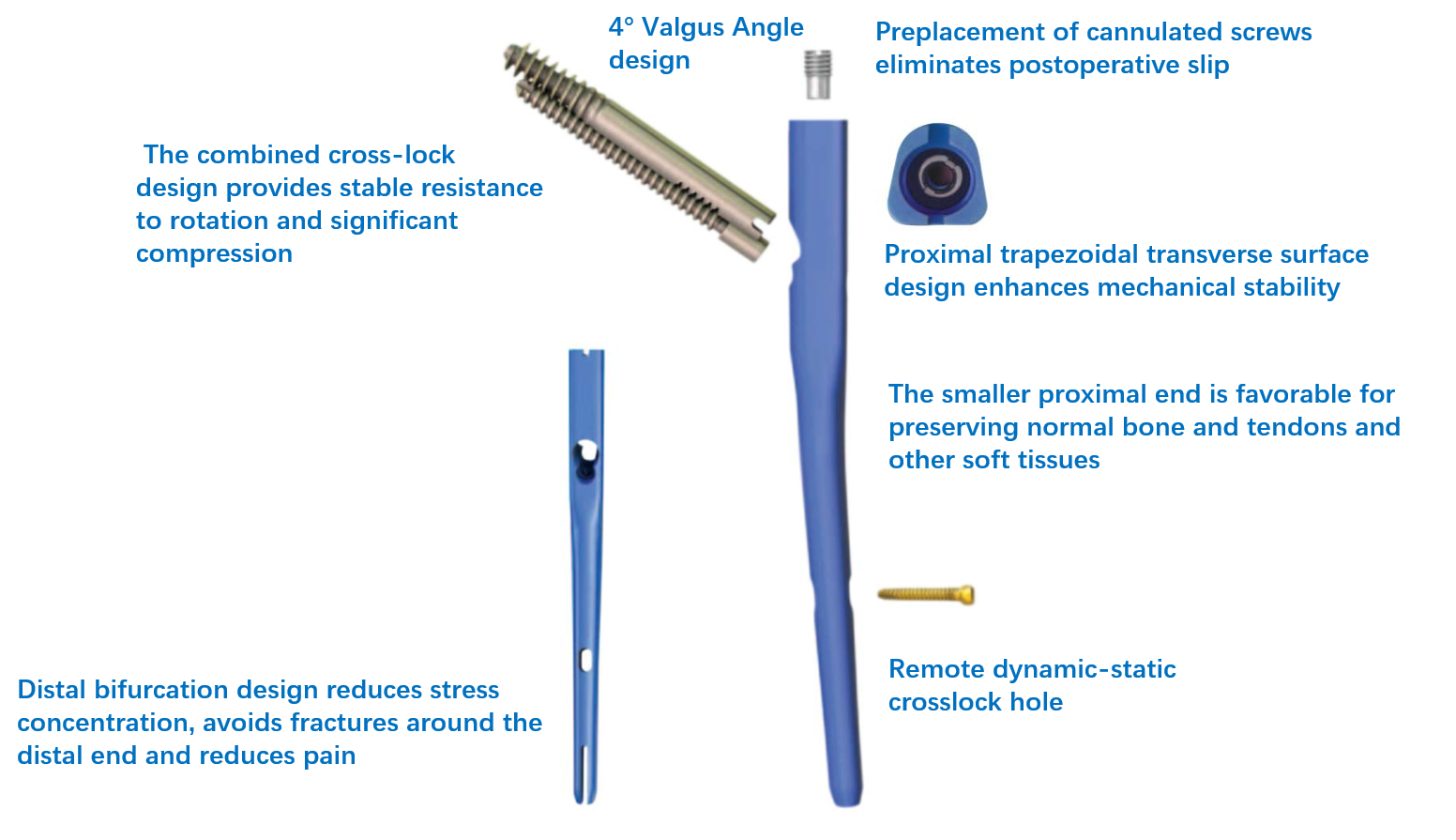 Intertan Nail System Overview