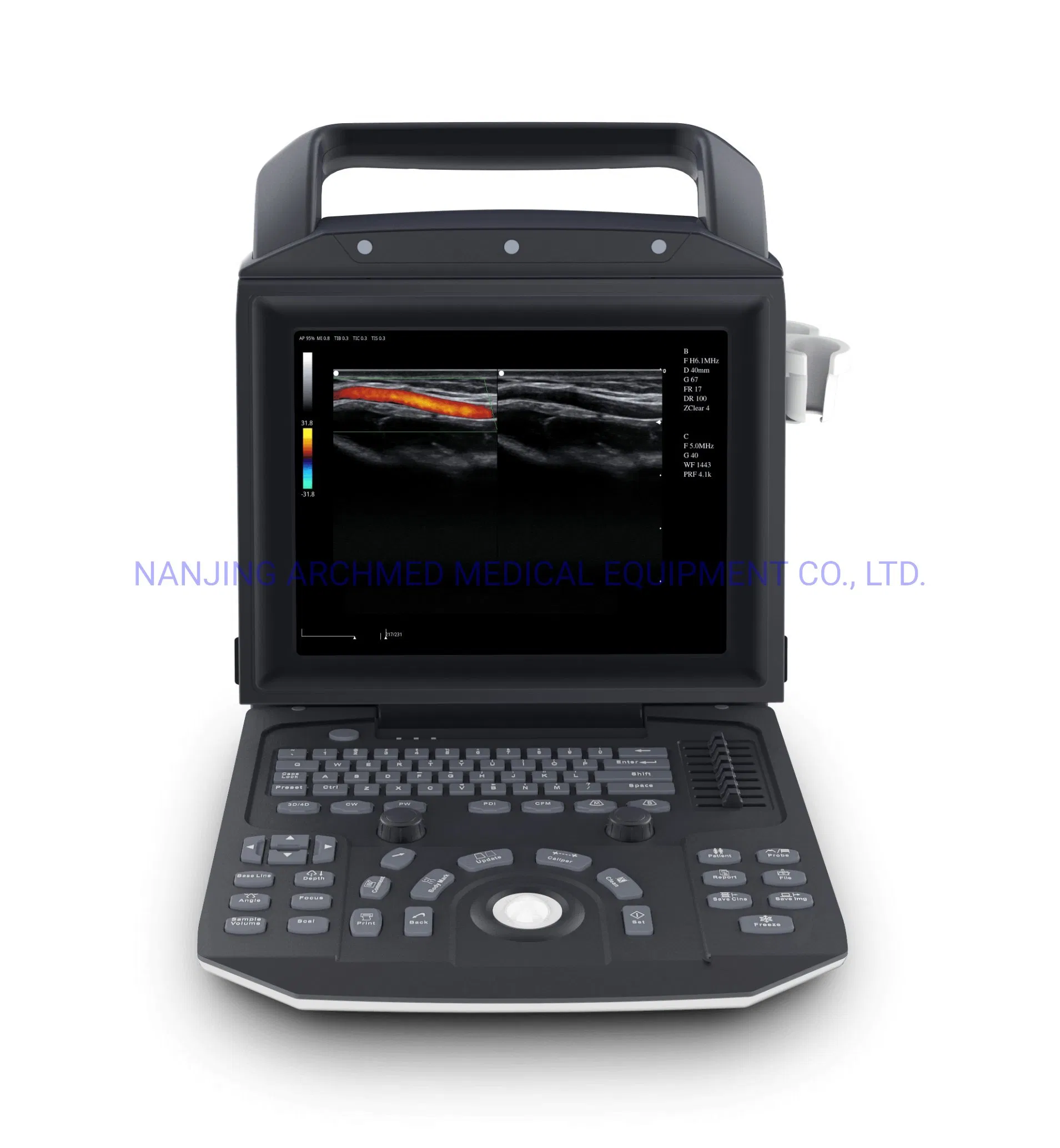 Medical Equipment Mobile Portable Color Doppler Ultrasound Scanner with 12″ LCD Monitor