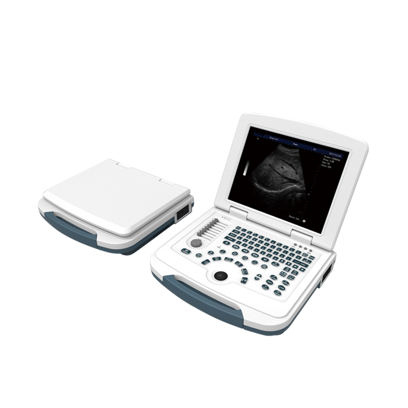 Portable Full Digital Laptop Ultrasonic Diagnostic System Ultrasound Scanner Machine with Probes for Clinic Hospital
