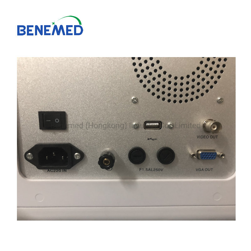 Portable B/W Ultrasound Scanner with Clear Image Quality