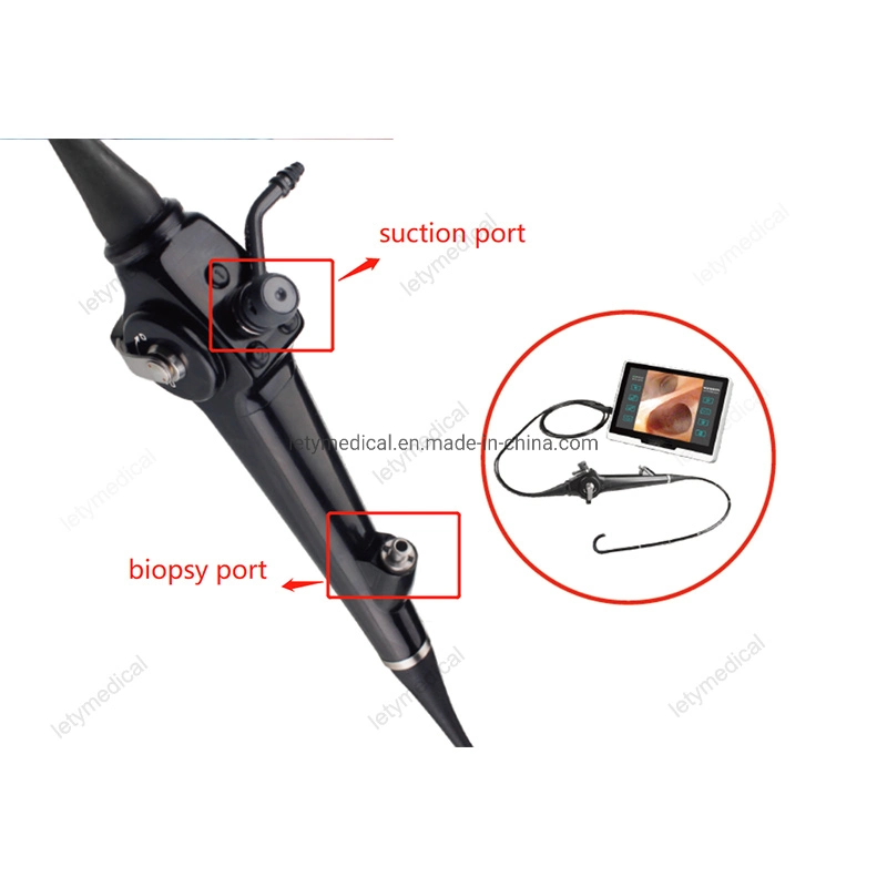 HD Flexible Video Choledochoscope Gallbladder Endoscope Electronic Endoscope
