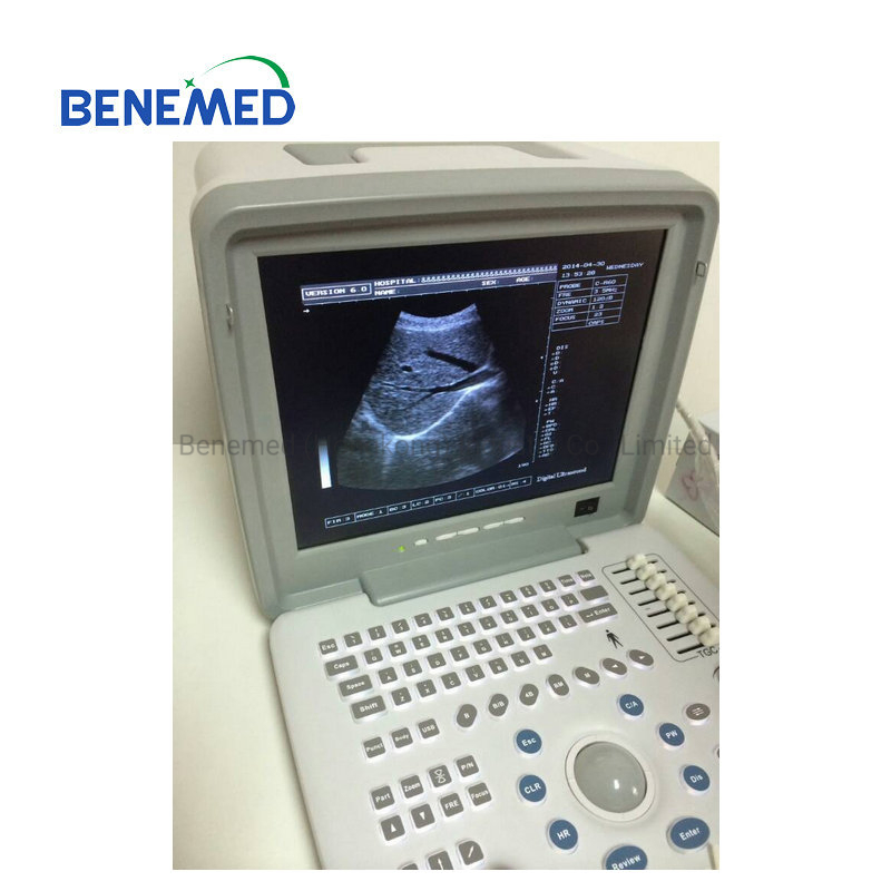 Portable B/W Ultrasound Scanner with Clear Image Quality