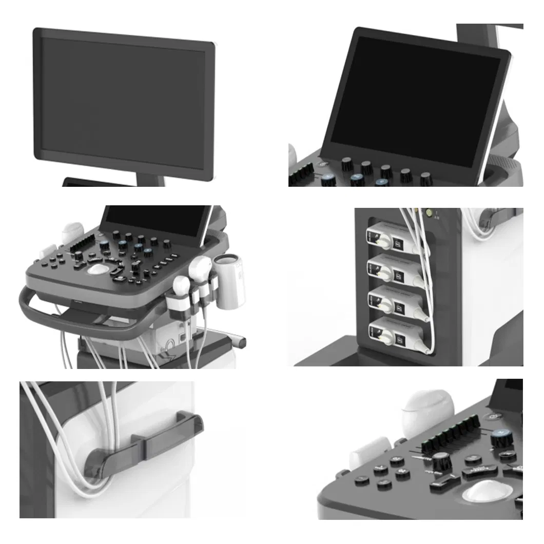 Medical Equipment Big Screen Trolley 4D Diagnostic Ultrasound Scanner