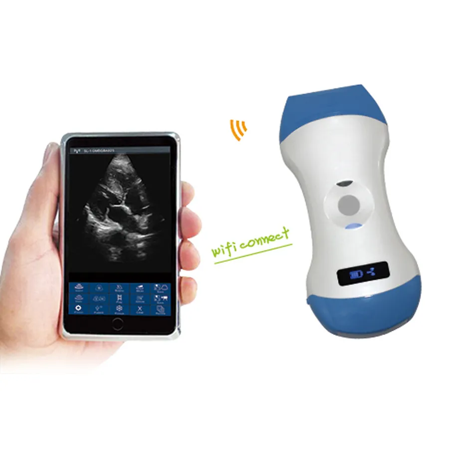 Wireless Handheld Ultrasound Probe Scanner 1