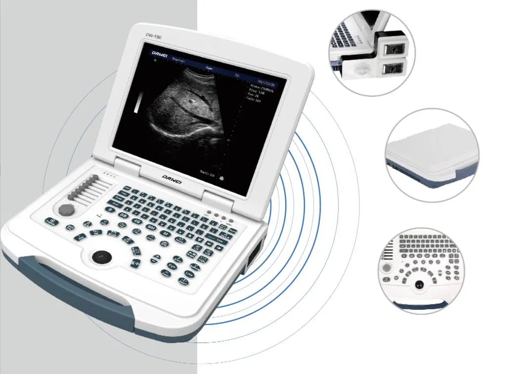 Ultrasound Scanner