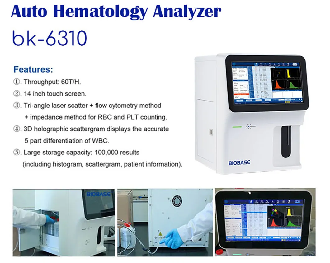 5 Part Hematology Analyzer