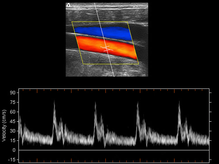 My-A024A 3D Color Doppler Ultrasound Scanner