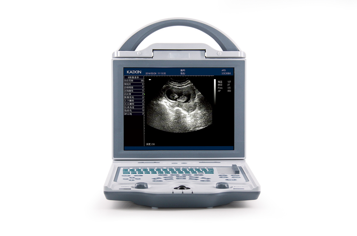 Durable/ Functional/ Affordable B/W Ultrasound Scanner for Human (KX5600)