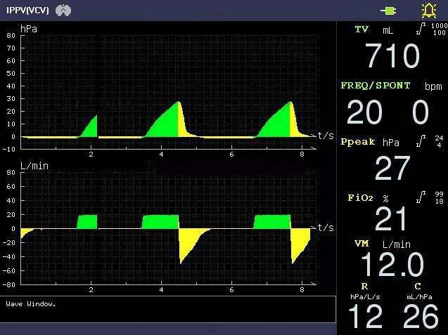 High Quality Hospital ICU Equipment Medical Anesthesiology ICU Anesthesia Machine