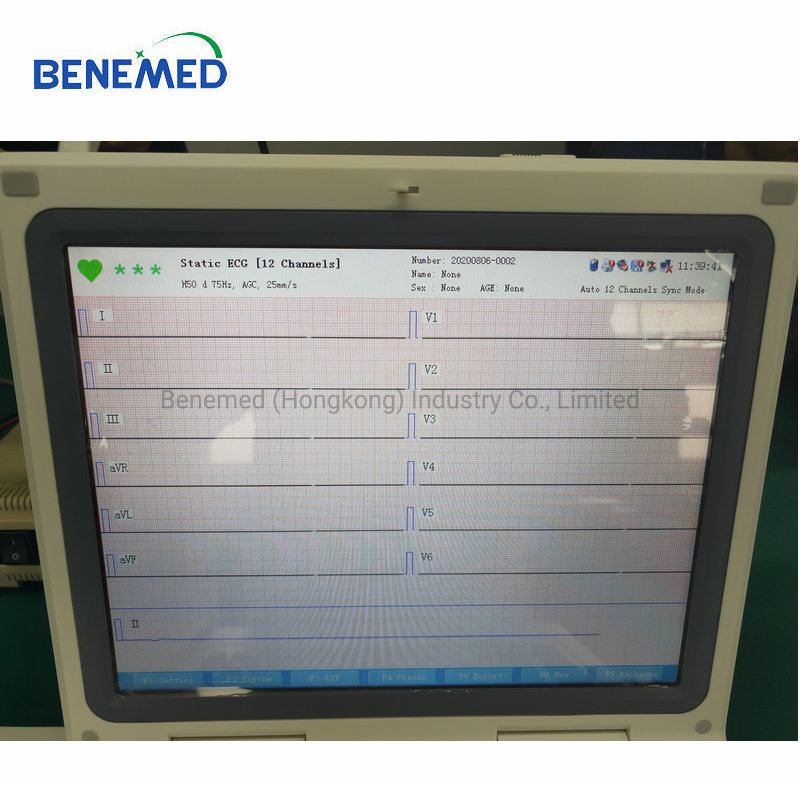 12 Inch Digital Hospital Electrocardiograph 12 Channel ECG Machine Bm-ECG12c