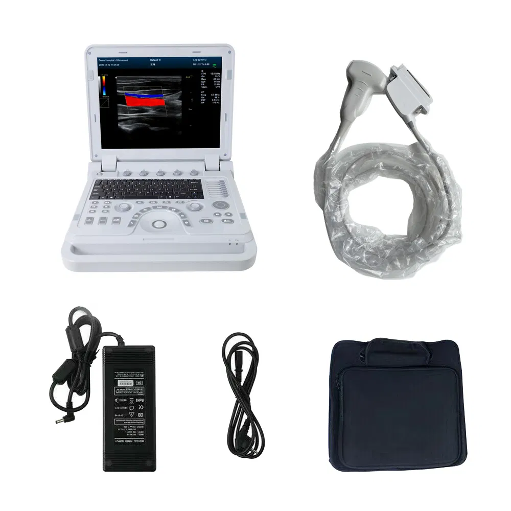 Contec Cms1700b Portable Laptop Color Doppler 4D Ultrasound Machine