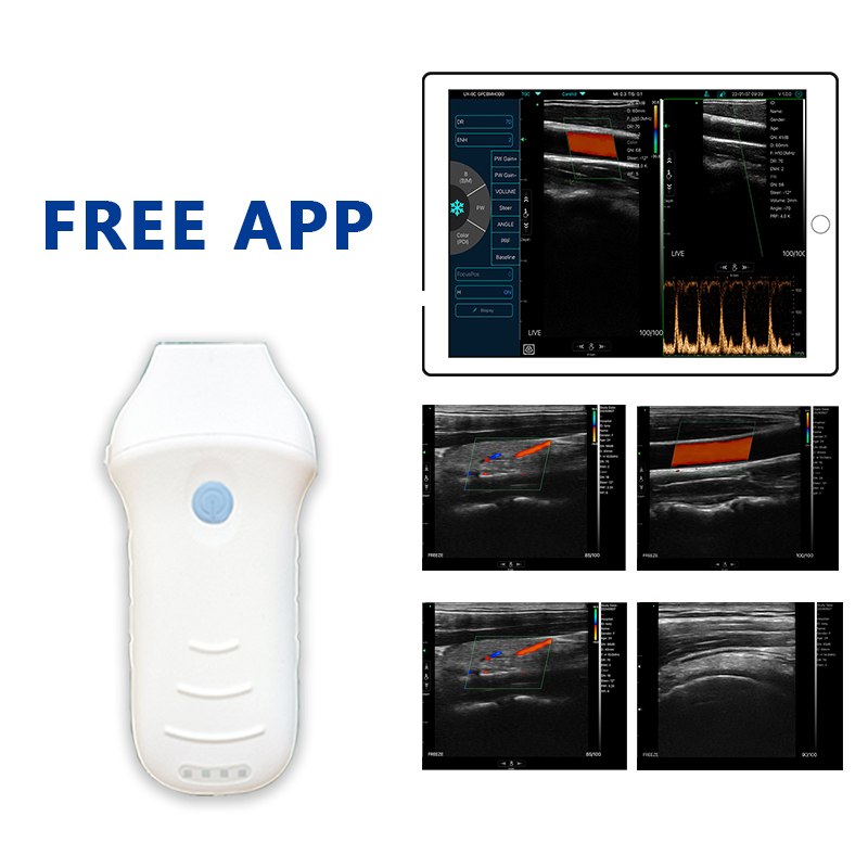 Konted C10CW Portable Cardiac Color Doppler Wireless Ultrasound Echo Scanner