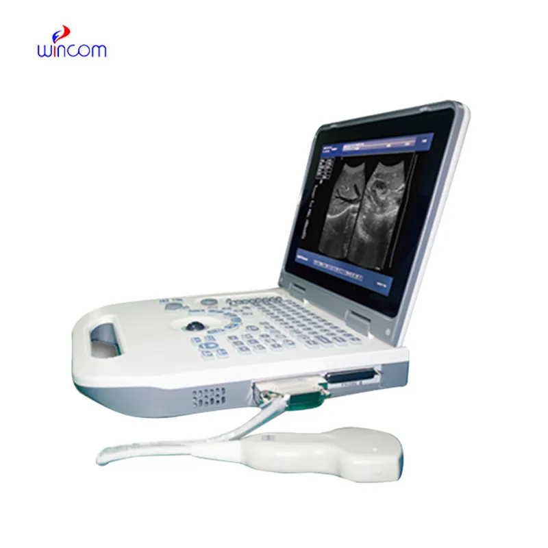 Laptop Ultrasound Scanner