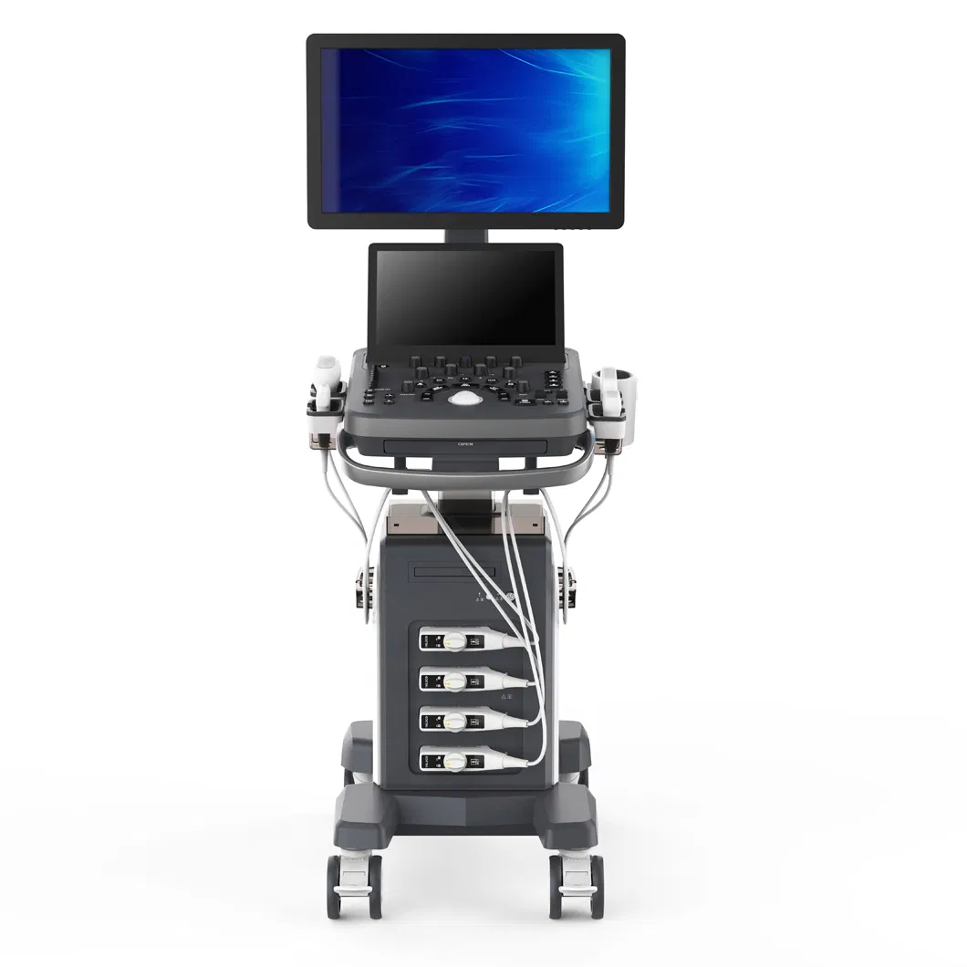 Medical Equipment Big Screen Trolley 4D Diagnostic Ultrasound Scanner