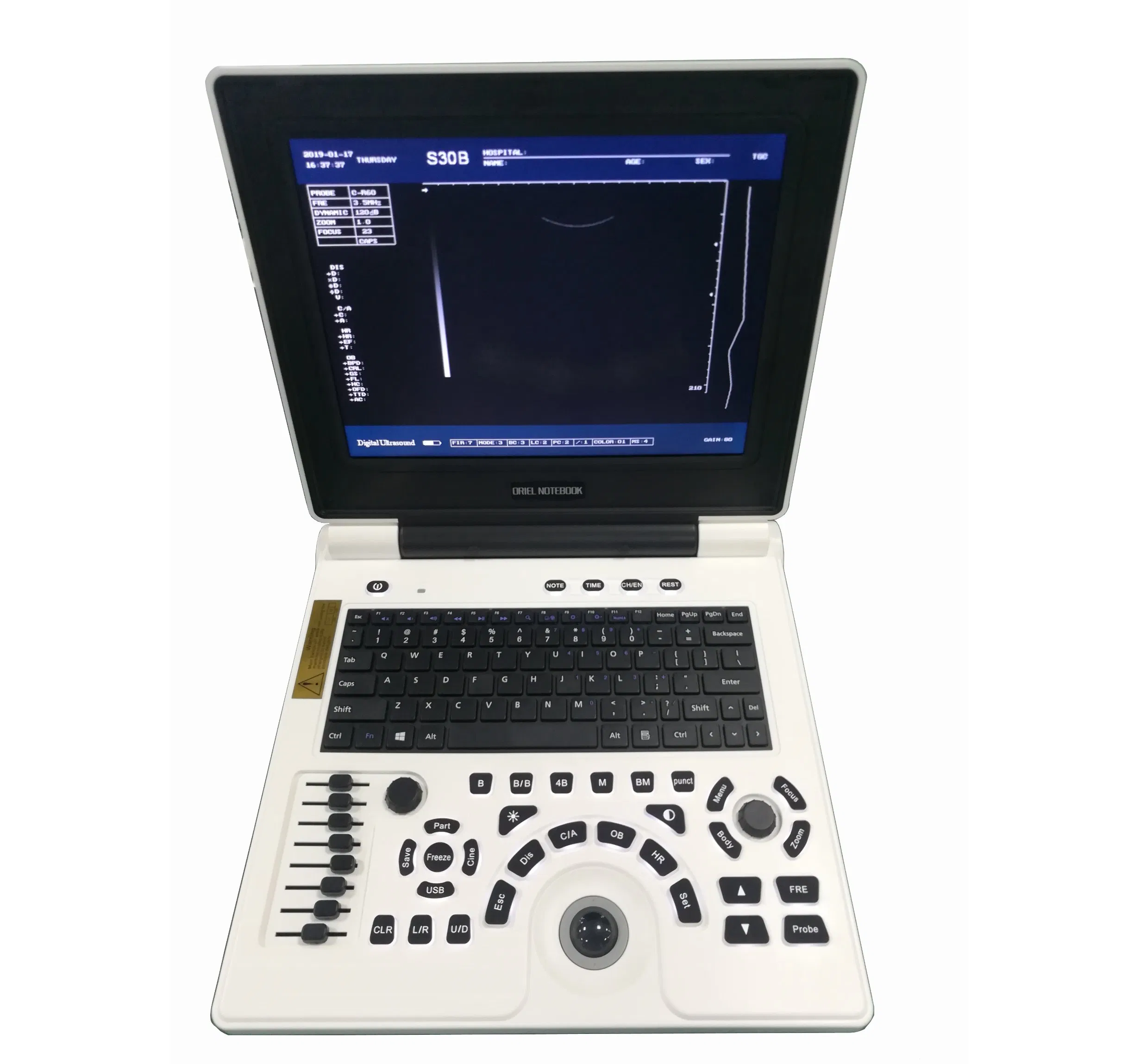 ISO13485 Xf30b Cheap Price Hottest Portable B/W Medical Ultrasound Machine Scanner