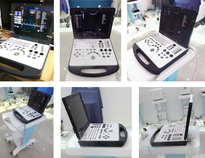 My-A024A 3D Color Doppler Ultrasound Scanner