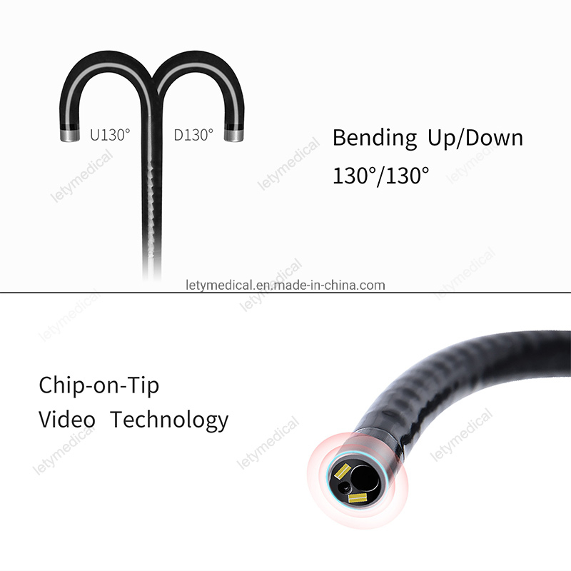 HD Flexible Video Choledochoscope Gallbladder Endoscope Electronic Endoscope