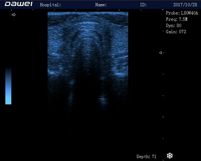 Ultrasound Image 4