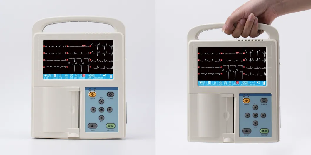 Electrocardiograph Display