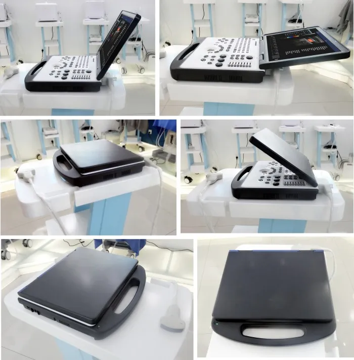 3D Color Doppler Ultrasound Scanner View 3