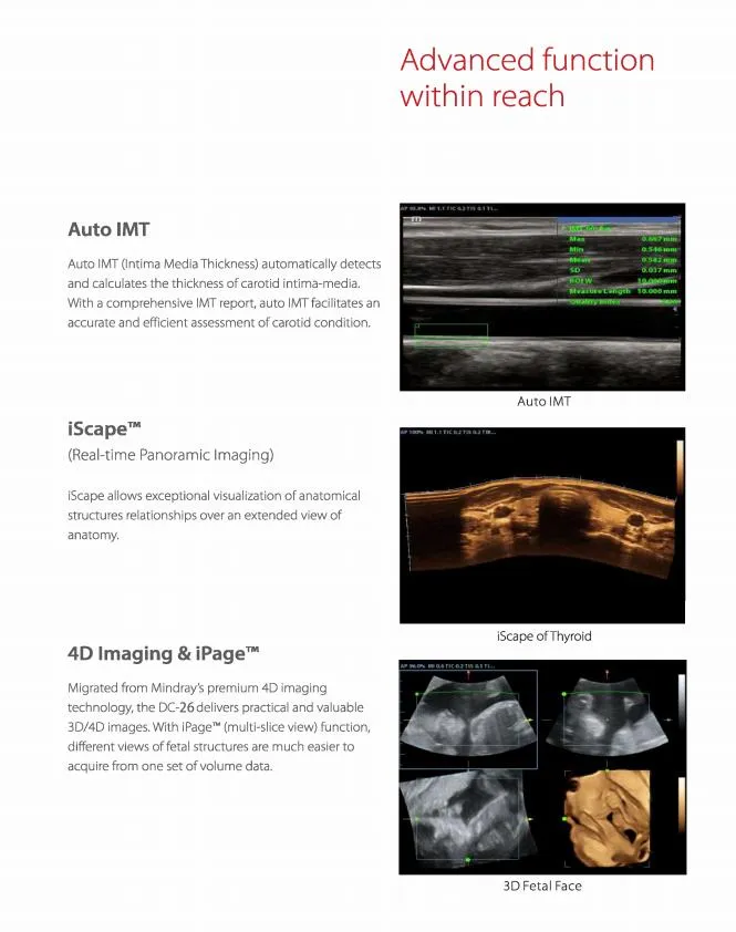 Ultrasound Scanner 2