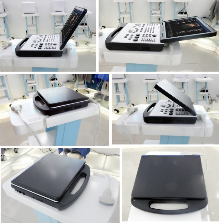 My-A024A 3D Color Doppler Ultrasound Scanner