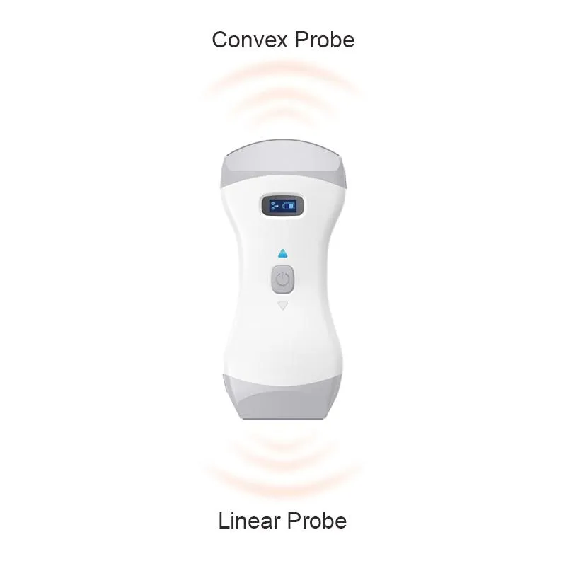 Handheld Ultrasound Scanner