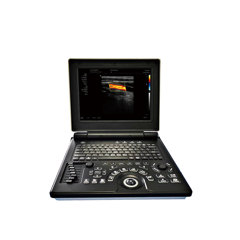 Portable Full Digital Laptop Ultrasonic Diagnostic System Ultrasound Scanner Machine with Probes for Clinic Hospital