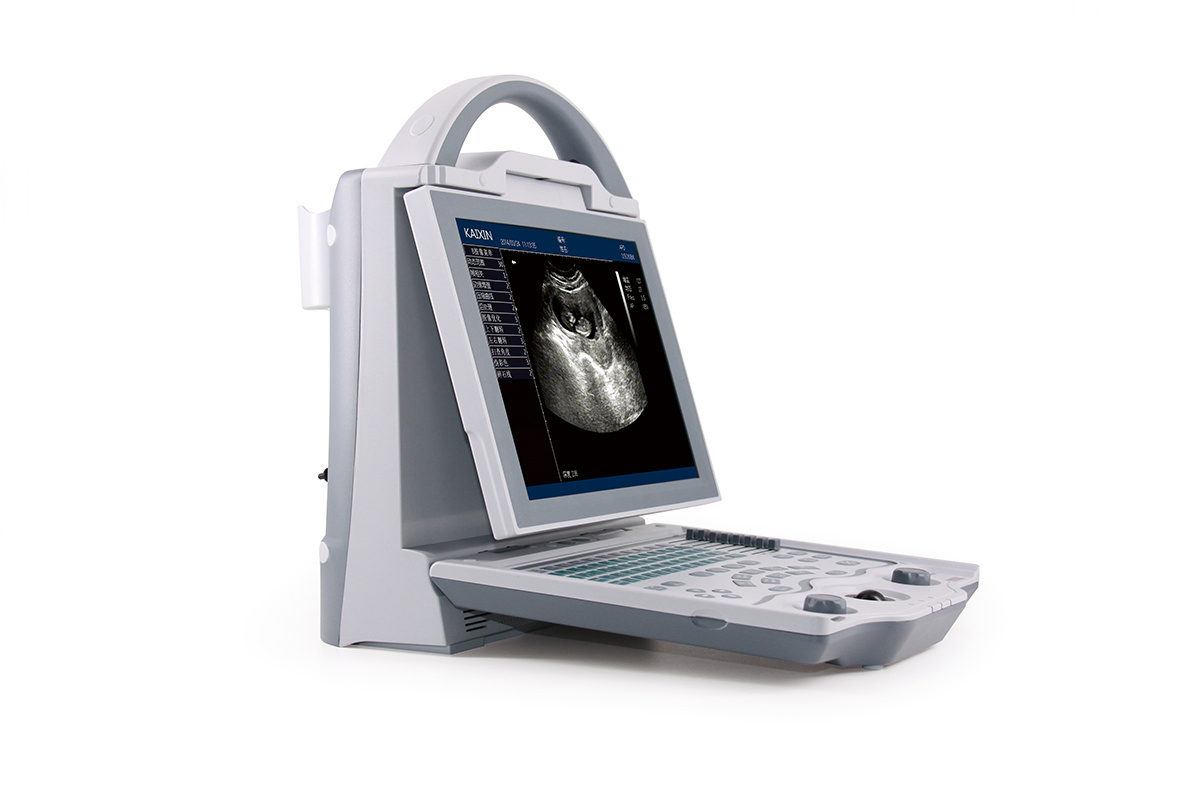 Durable/ Functional/ Affordable B/W Ultrasound Scanner for Human (KX5600)
