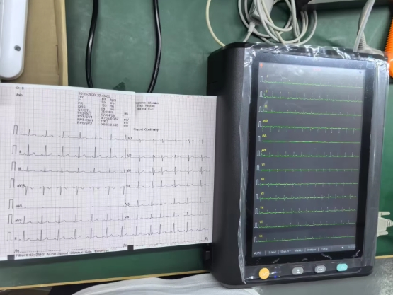 ECG1210-12 Channel Electrocardiograph Machine Portable Digital ECG