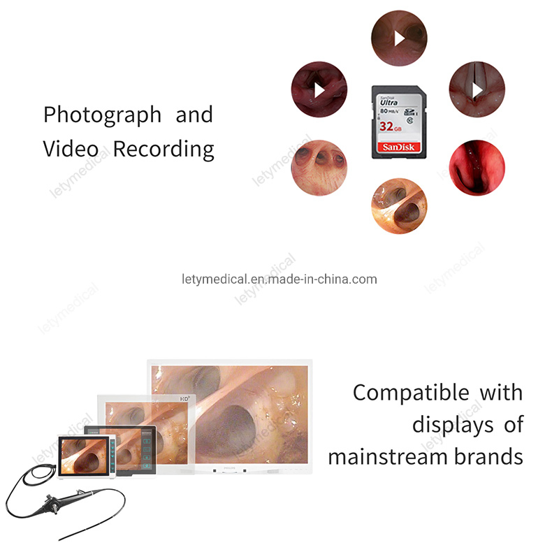 HD Flexible Video Choledochoscope Gallbladder Endoscope Electronic Endoscope