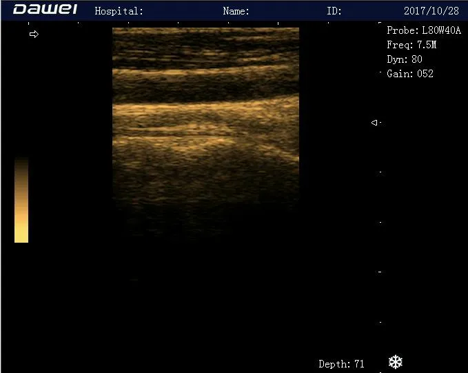 Ultrasound Image 5