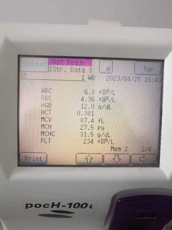 Fully Automatic Detection Equipment Used Sysmex Poch-100I Hematology Analyzer