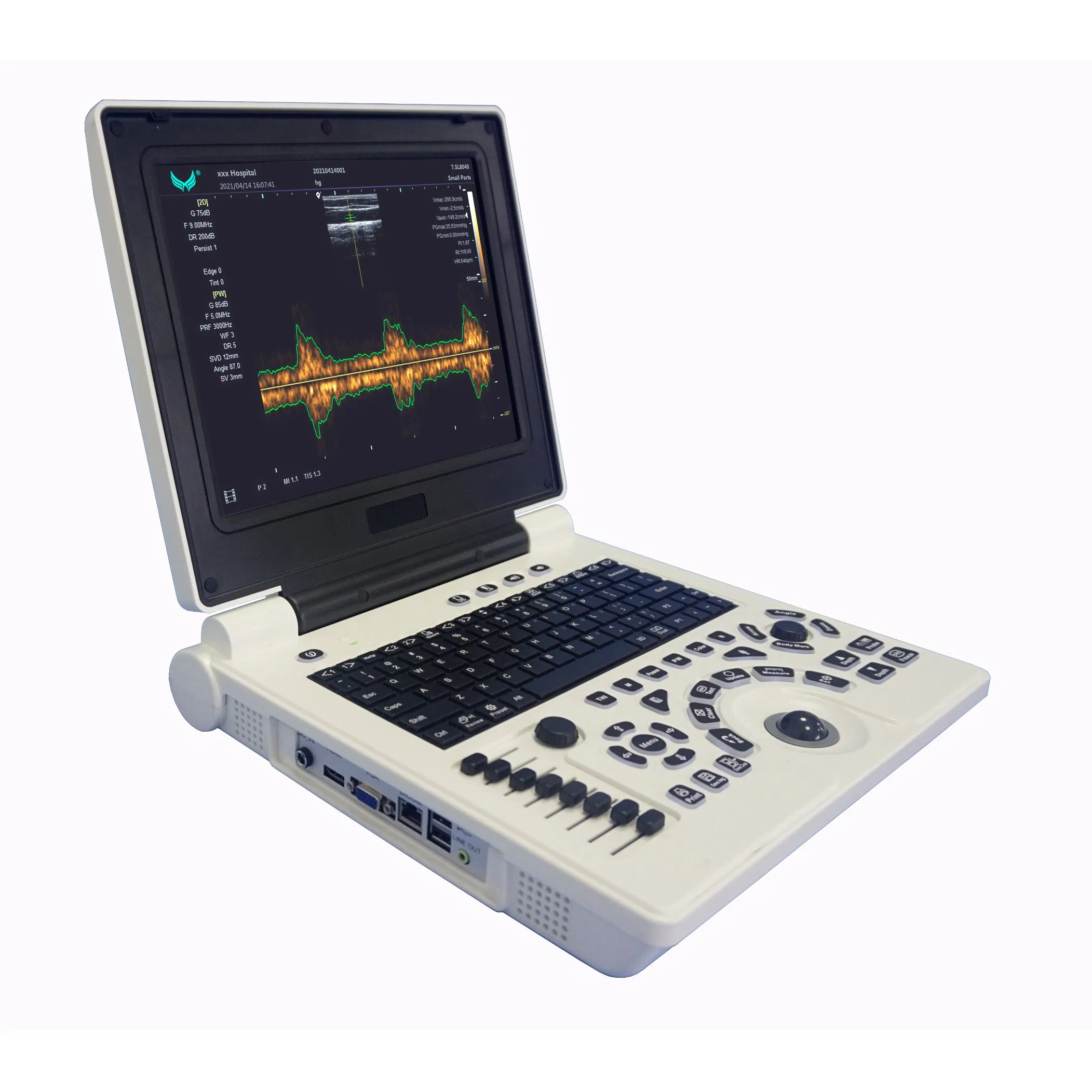 U10b Ultrasound Equipment Black and White Cheap Price Laptop Ultrasound Scanner