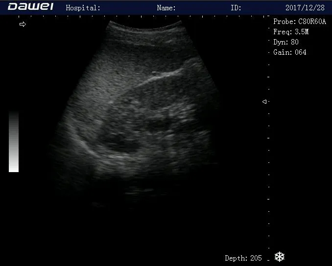 Ultrasound Image 1
