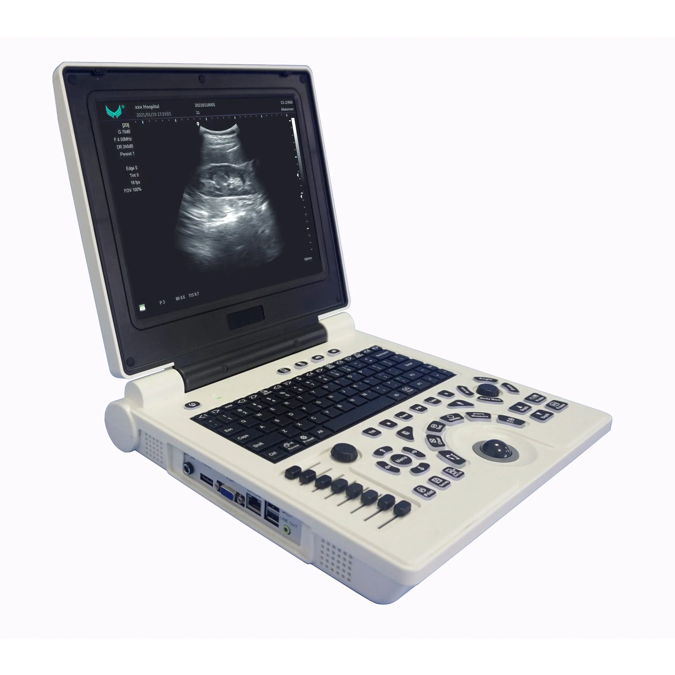 U10b Ultrasound Equipment Black and White Cheap Price Laptop Ultrasound Scanner