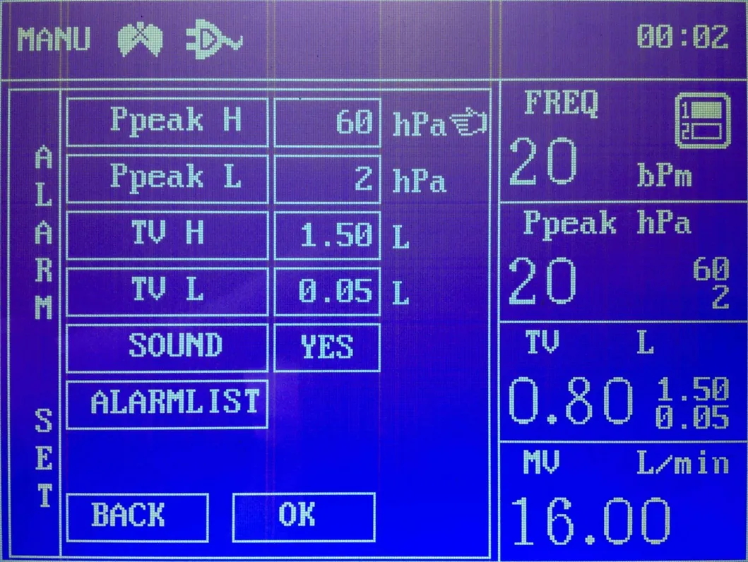 Anesthesia Device Interface