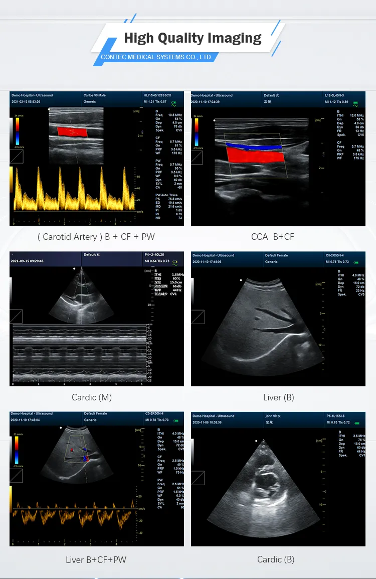 Ultrasound Device View 3