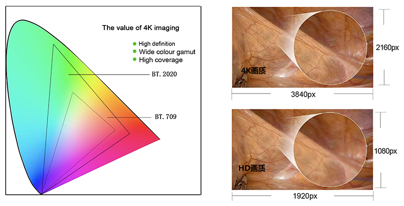 Medical 4K UHD Laparoscopic Tower Complete Endoscope Camera System Set